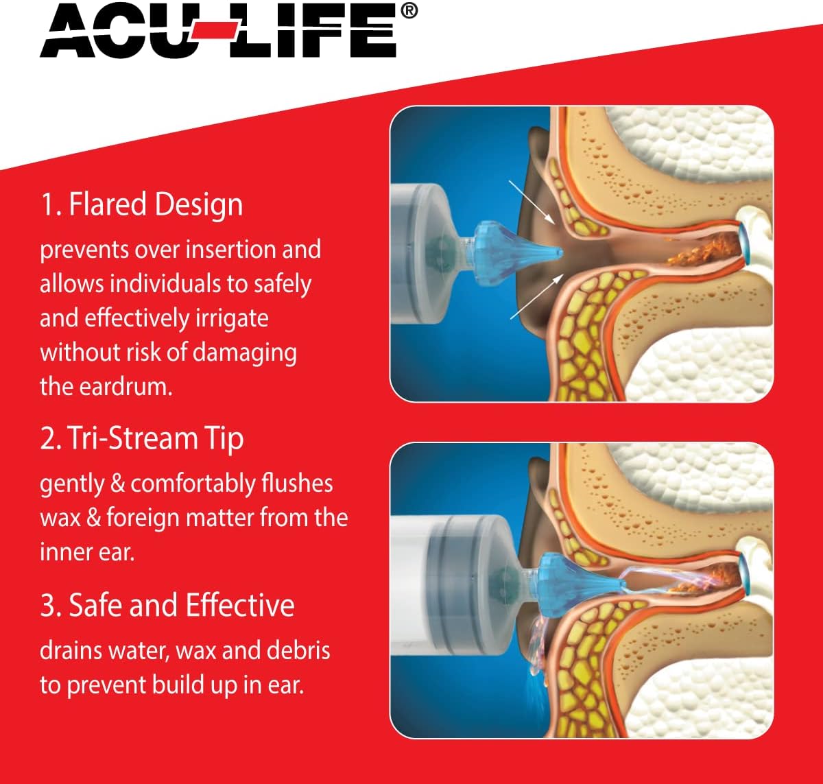 Acu-Life® Ear Irrigator with Soft Tri-Steam Fit (Includes Basin, Ear Syringe and Easy Squeeze Bottle)